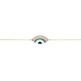 EYES ON YOU ARMBAND 2